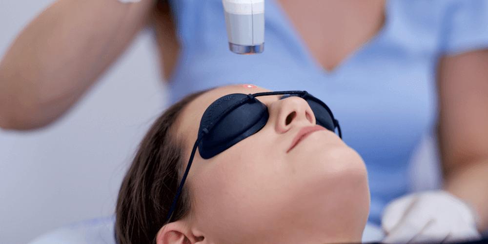 img/acne-treatments/acne-laser.png