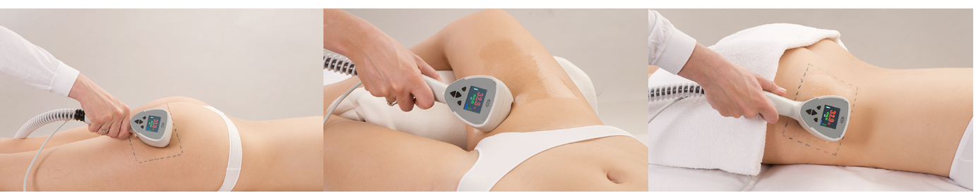 BTL Exilis image