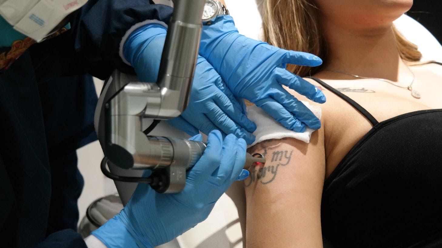 Fotona Laser Tattoo Removal image